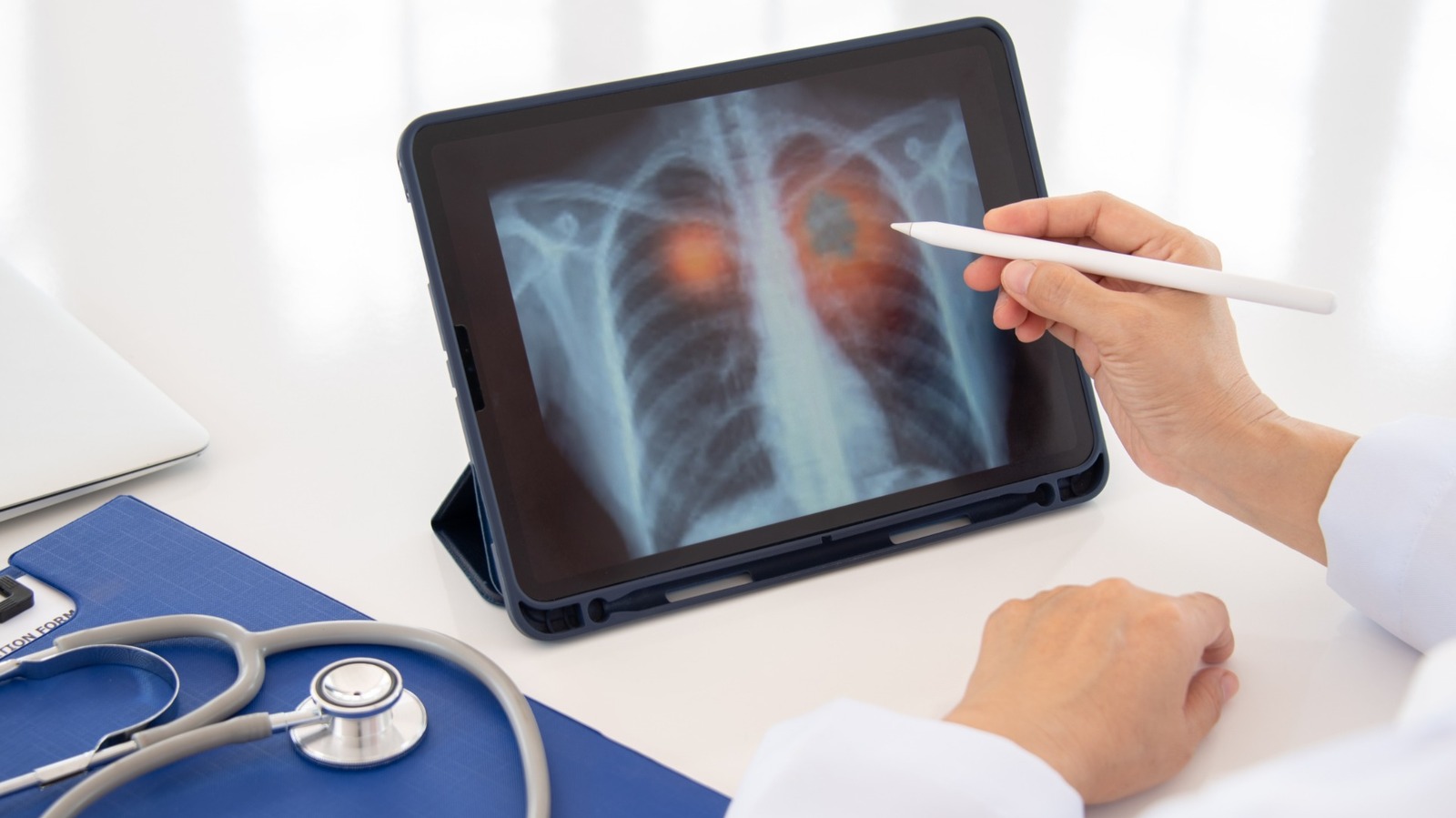 Эта невероятно важная медицинская технология была обнаружена полностью случайно